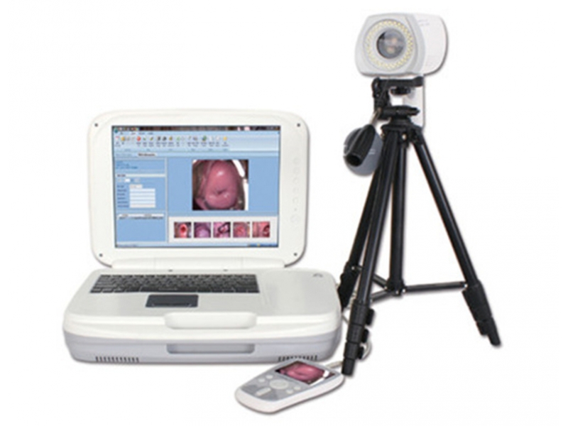YKD-3004 Portable Digital Colposcope