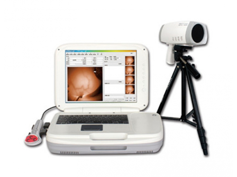 YKD-1004 Portable Infrared Breast Examination Equipment