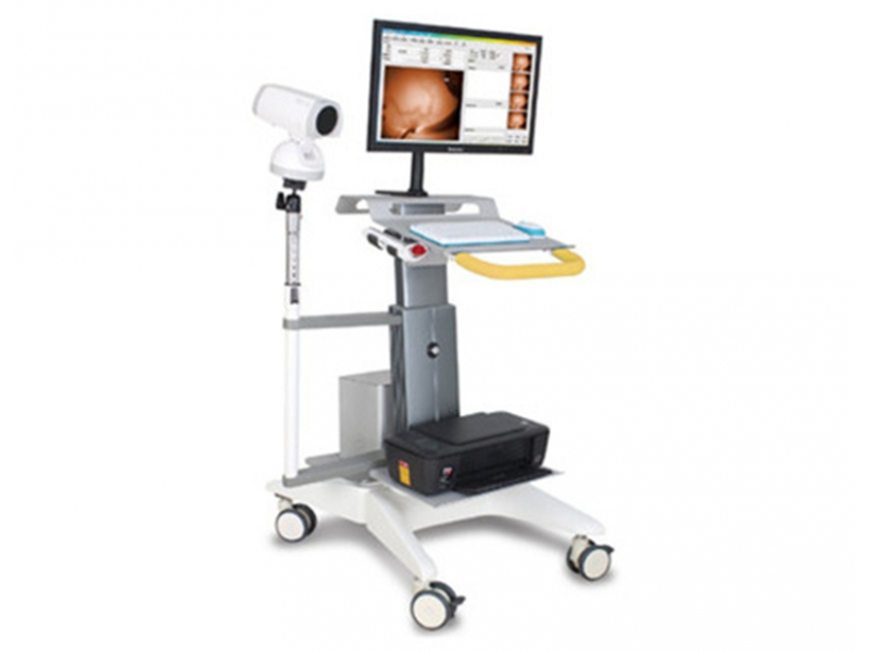 YKD-1001 Full HD Infrared Mammary Gland Examination System