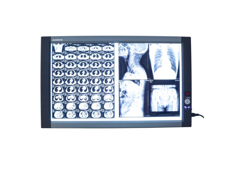 Portable Double X Ray Film Scanner Viewing Box Medical LED X-ray Radiography Xray Film Viewer